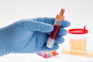 Подготовка к проведению и разновидности протокола таргетной химиотерапии