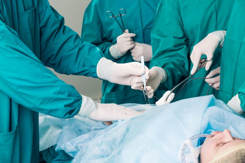 Лапароскопическая гистерэктомия в Израиле | Центр рака CTC