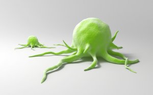 Лимфосаркома