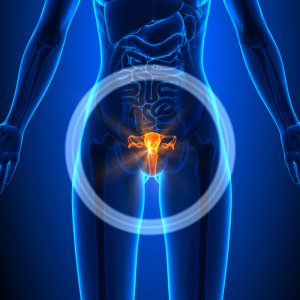 диагностика аденокарциномы матки в Израиле