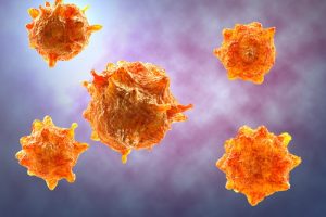 Карциноид: общие сведения