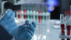 Диагностика нейрофиброматоза в Израиле 